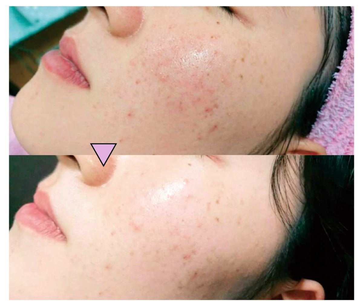 Cosmetic salon view(ビュー)【bibibi 2025 Summer】夏のダメージが、秋には老化の原因に 来年40周年の安心サロンで肌ケアを