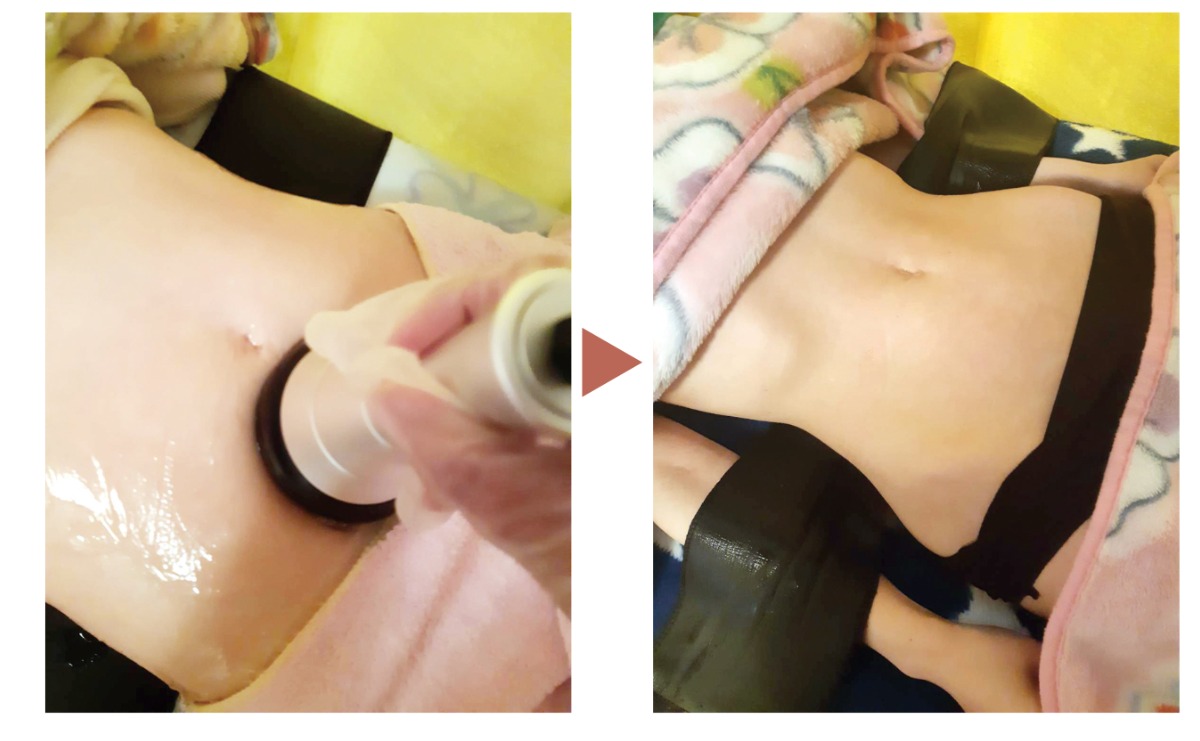 STUDIO FREE（スタジオフリー）【bibibi 2026 Spring】エステが半額！ 朝活も継続中