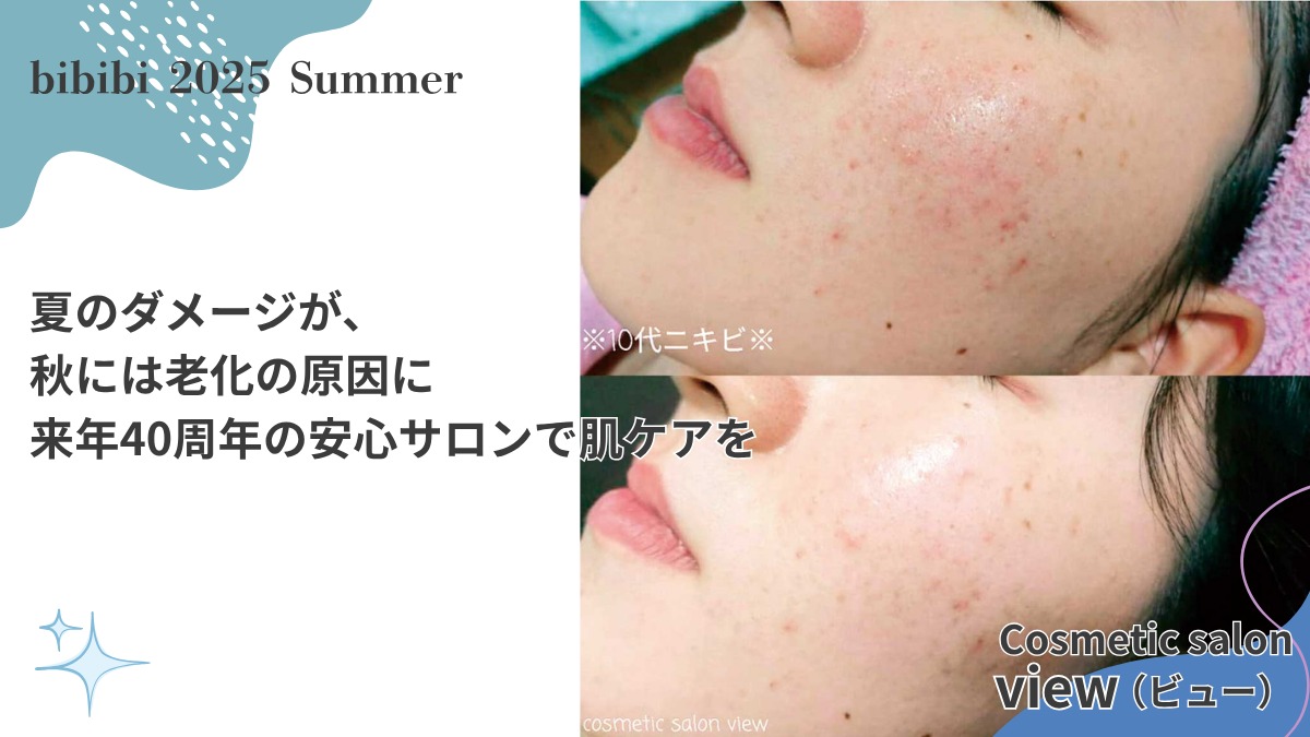 Cosmetic salon view（ビュー）【bibibi 2025 Summer】夏のダメージが、秋には老化の原因に 来年40周年の安心サロンで肌ケアを