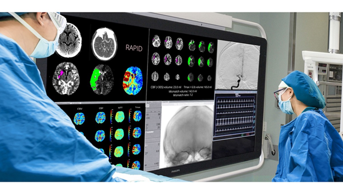 【NEW】脳梗塞の急性期治療の向上に向け脳画像解析プログラムを四国初導入｜社会医療法人石川記念会 HITO病院